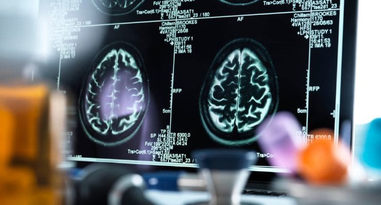 Our Neurology Medical Billing Services